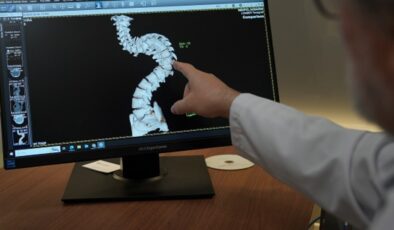 Skolyoz hastalığında erken teşhisin önemi