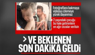 Denizli’de 2 yaşındaki bebeğe vahşeti yaşatan anne ile sevgilisi gözaltında