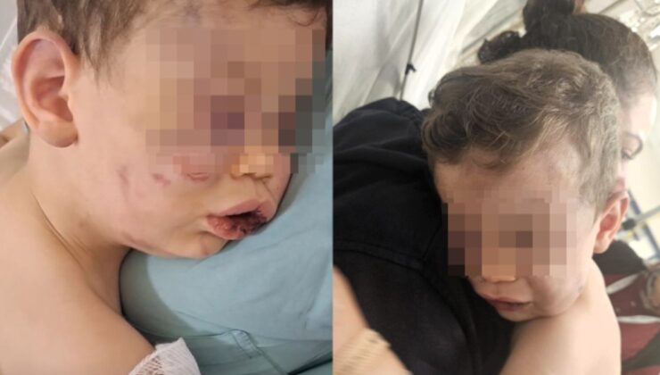 Denizli’de 2 yaşındaki bebek öldüresiye darbedildi