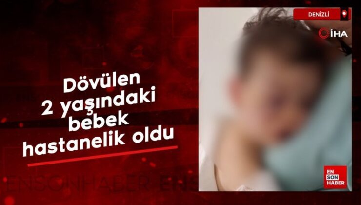 Denizli’de dövülen 2 yaşındaki bebek hastanelik oldu