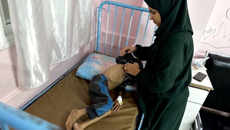 Gazze’de çocukların yetersiz beslenme vakaları giderek artıyor