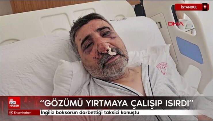 İngiliz boksörün darbettiği taksici konuştu