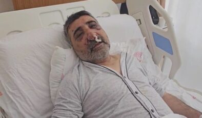 İstanbul’da İngiliz boksörün darbettiği taksici konuştu