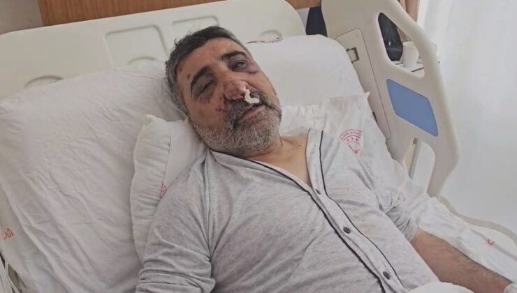 İstanbul’da İngiliz boksörün darbettiği taksici konuştu