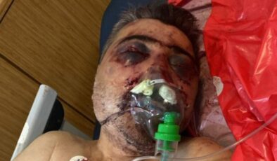 İstanbul’da İngiliz boksörün darbettiği taksicinin ağabeyi konuştu