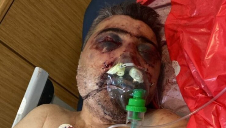 İstanbul’da İngiliz boksörün darbettiği taksicinin ağabeyi konuştu