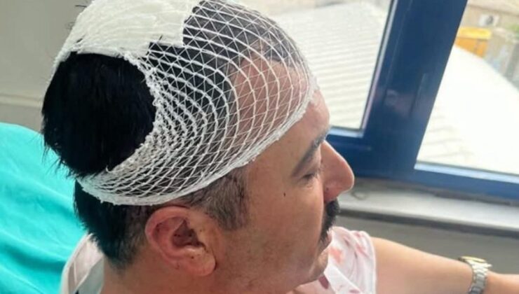 Kahramanmaraş’ta belediye başkanı yardımcısına ‘şekerlikli’ saldırı