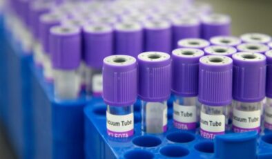 Kanseri tespit edebilen kan testi yüzde 99 doğruluk oranına ulaştı