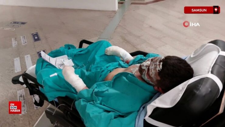 Samsun’da ateşe tiner döken genç alevler içinde kalarak ağır yaralandı