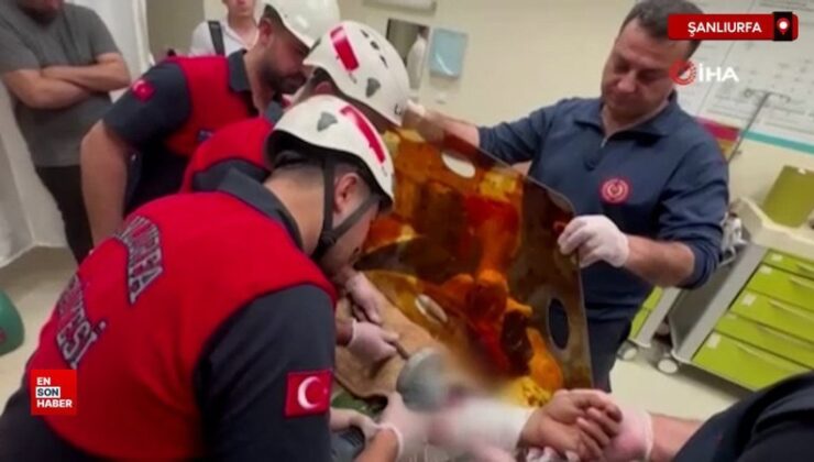Şanlıurfa’da koluna saplanan demir şişle ameliyata alındı