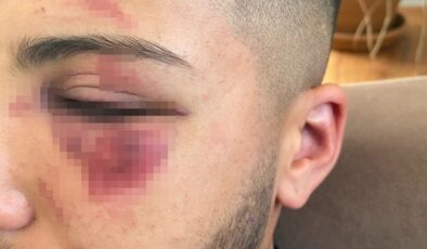 Yalova’da 4 kişi tarafından defalarca bıçaklandı