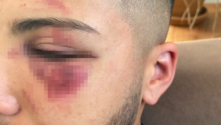 Yalova’da 4 kişi tarafından defalarca bıçaklandı