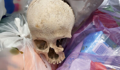 Adana’da çöpten beşere ilişkin kafatası çıktı