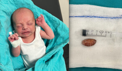 Batman’da 16 günlük bebeğin boğazından badem şekeri çıkarıldı