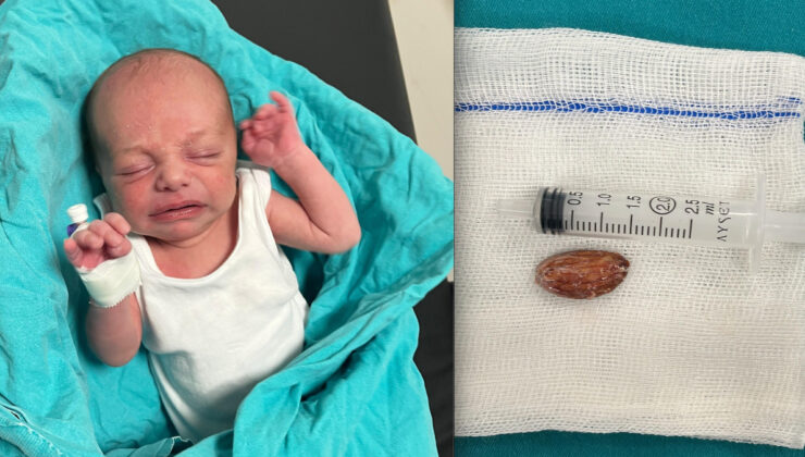 Batman’da 16 günlük bebeğin boğazından badem şekeri çıkarıldı