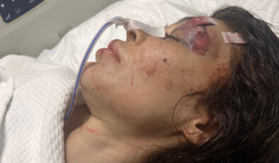 Beşiktaş’ta şikayet ettiği spor salonu sahibi tarafından bıçaklandı