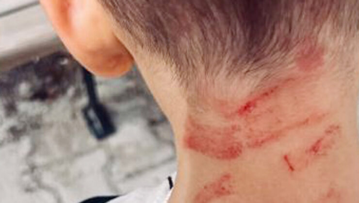 Burdur’da özel ihtiyaçlı çocuğa darp: Soruşturma açıldı