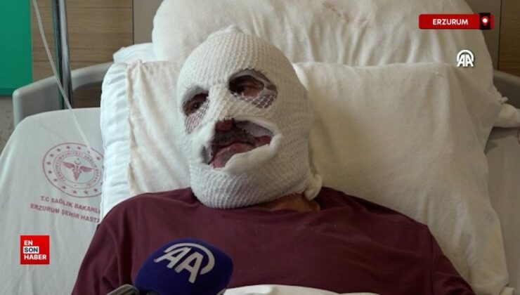 Erzurum’da tüpteki gaz kaçağını çakmakla denetim edince hastanelik oldu