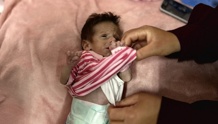 Gazze’de bir bebek daha açlık yüzünden can vermek üzere