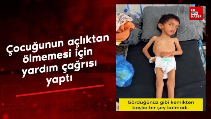 Gazze’de çocuğunun açlıktan ölmemesi için yardım daveti yaptı