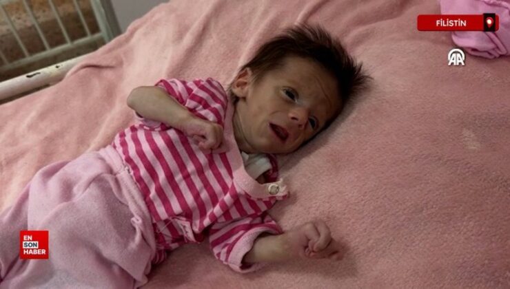 Gazze’de çocuklar yetersiz beslenme ile uğraş ediyor