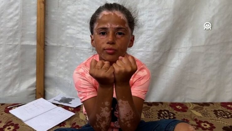 İsrail’in hücumları nedeniyle saçlarına aklar düştü