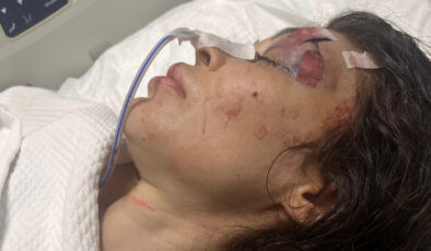 İstanbul’da şikayet ettiği spor salonu sahibi tarafından bıçaklandı: Hayati tehlikesi sürüyor