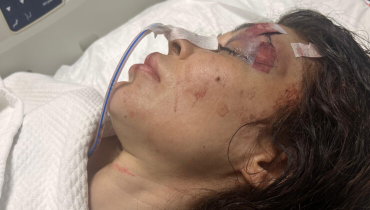 İstanbul’da şikayet ettiği spor salonu sahibi tarafından bıçaklandı: Hayati tehlikesi sürüyor