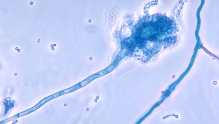 Son araştırma: Global ısınma ölümcül mantar hastalığını yayabilir