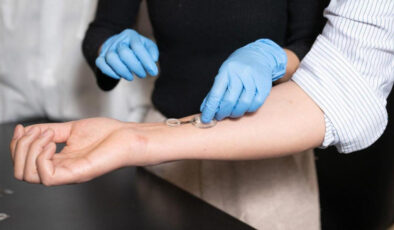 Enfeksiyonu günler öncesinden tespit eden akıllı bandaj çıktı