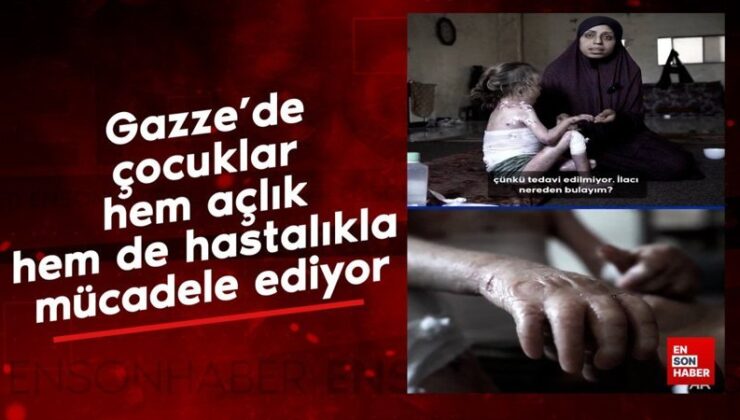 Gazze’de çocuklar hem açlık hem de hastalıkla çaba ediyor