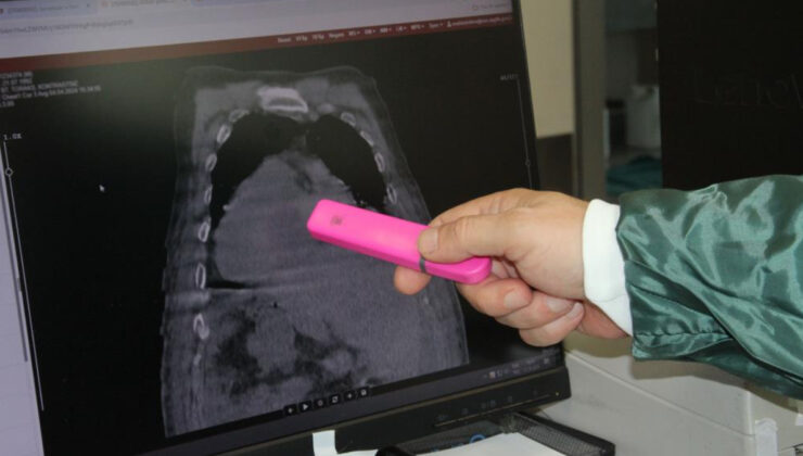 Giresun’dan tıp dünyasına katkı: Karadeniz Sendromu