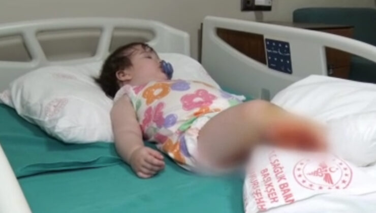 İstanbul’da üzerine çaydanlık devrilen 1 yaşındaki bebek dehşeti yaşadı