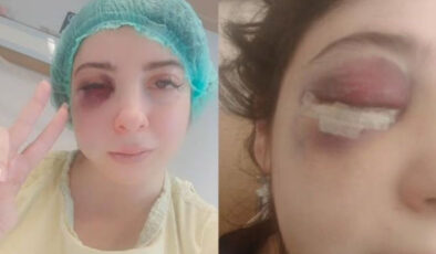 Samsun’da sokak ortasında darbedilen Damla: Platinler daima yüzümde kalacakmış