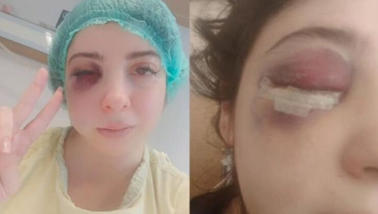 Samsun’da sokak ortasında darbedilen Damla: Platinler daima yüzümde kalacakmış