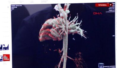 Türkiye’de birinci defa yapılan ameliyatla sıhhat buldu; dünyada ikinci hadise