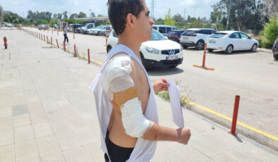 Adana’da kurt köpeğinin saldırısına uğradı