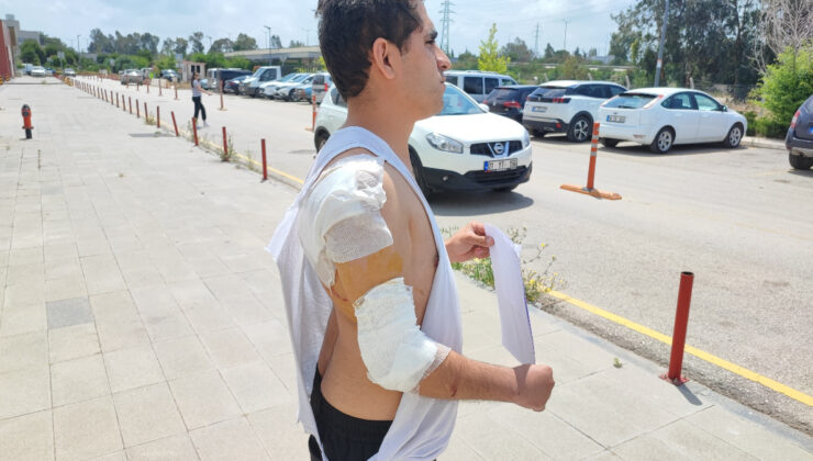 Adana’da kurt köpeğinin saldırısına uğradı