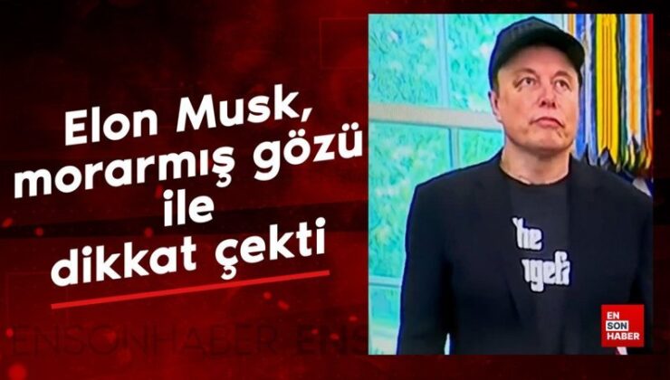 Elon Musk, Beyaz Saray’daki görüşmede morarmış gözü ile dikkat çekti