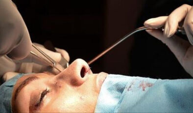 Estetik artık gençlerin tercihi: Yaş 18’in altına indi