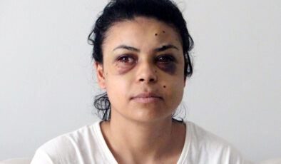 Kırklareli’de maganda pencereden Nazar’ı yaraladı