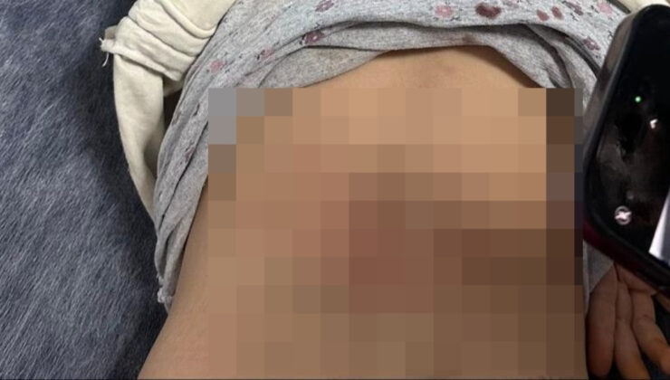 Mardin’de küçük çocuğa başıboş köpekler saldırdı