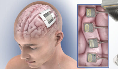 Neuralink rakibi şirket, bu yıl birinci beyin implantını üretecek