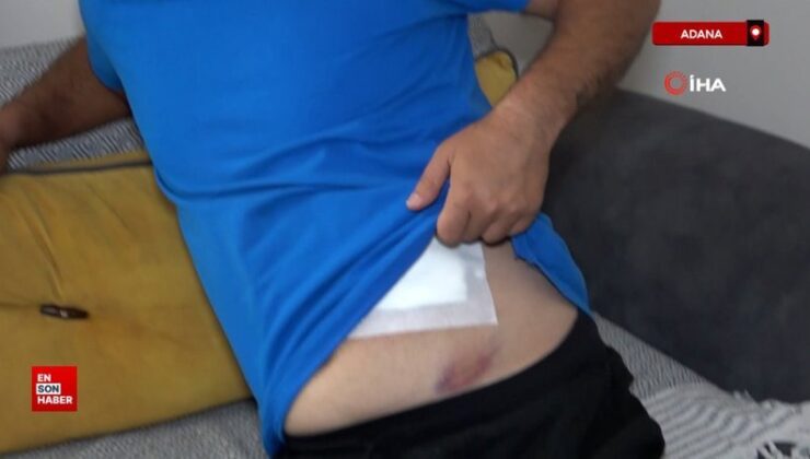 Adana’da bayramlaşmaya gitti, karnına yorgun mermi isabet etti