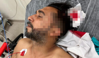 Adana’da döner ustası çalışırken başına yorgun mermi düştü