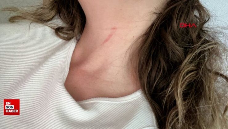 Bursa’da genç bayana gaspçı dehşeti