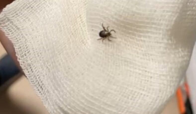 Eskişehir’de kene paniği: Eline çarpınca fark etti