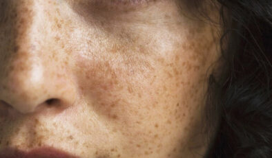 Güneş lekelerine İbn-i Sina yolu: Silgi üzere siliyor…