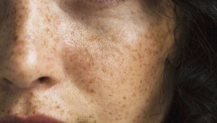 Güneş lekelerine İbn-i Sina yolu: Silgi üzere siliyor…