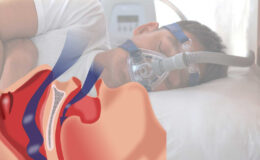 Uzmanlardan bayram dönüş yolunda ‘uyku apnesi’ uyarısı